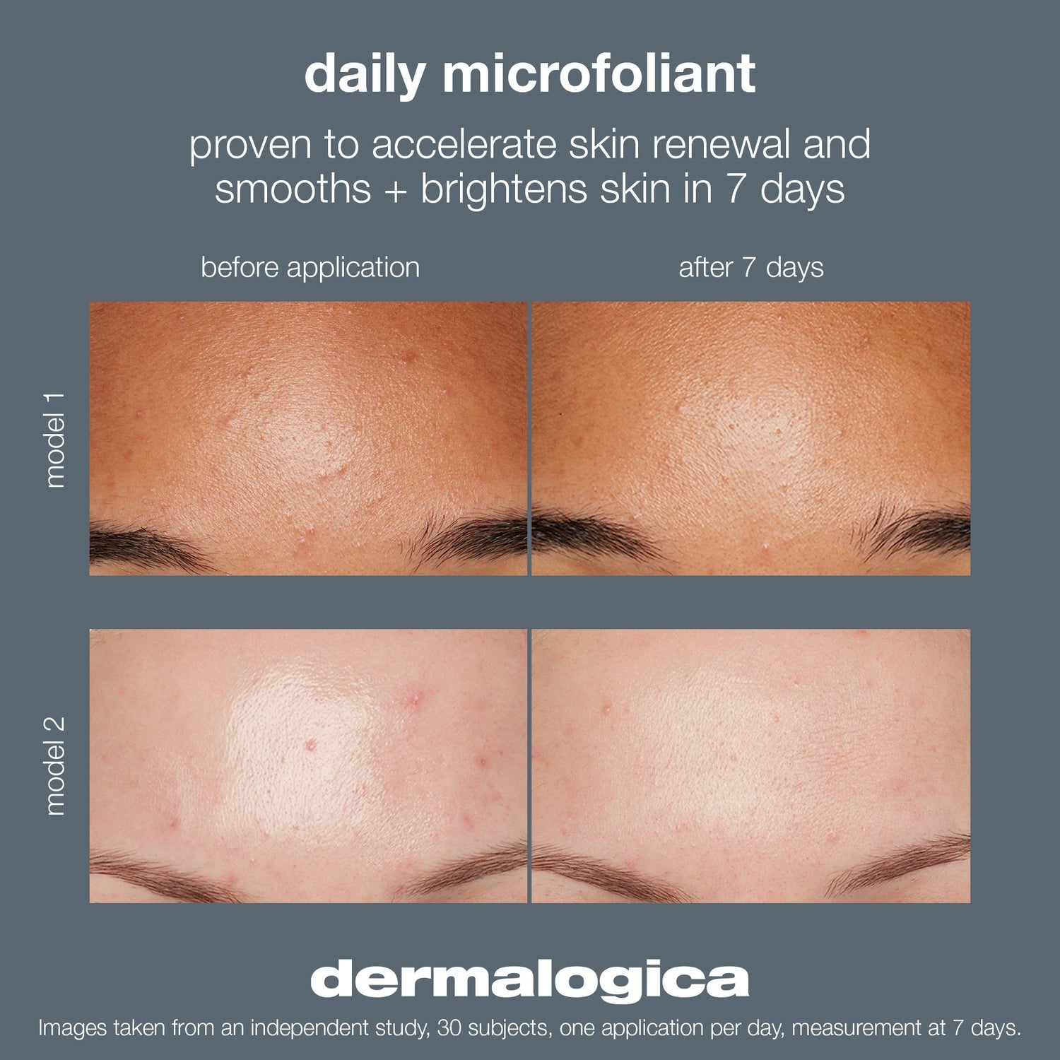 Dermalogica Daily Microfoliant