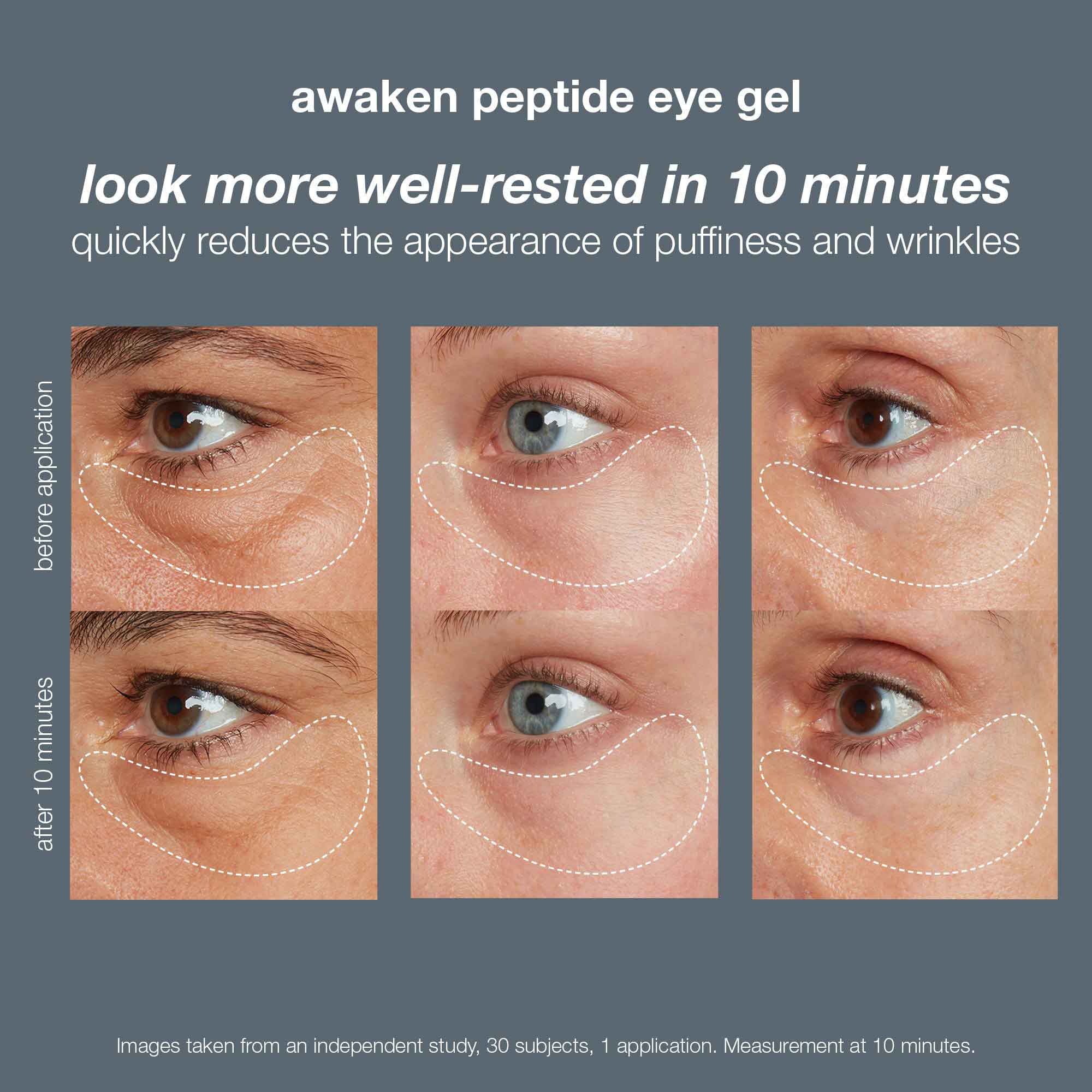 Dermalogica Awaken Peptide Depuffing Eye Gel