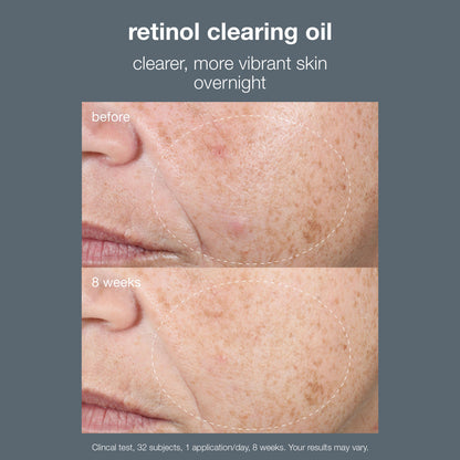 Dermalogica Retinol Clearing Oil